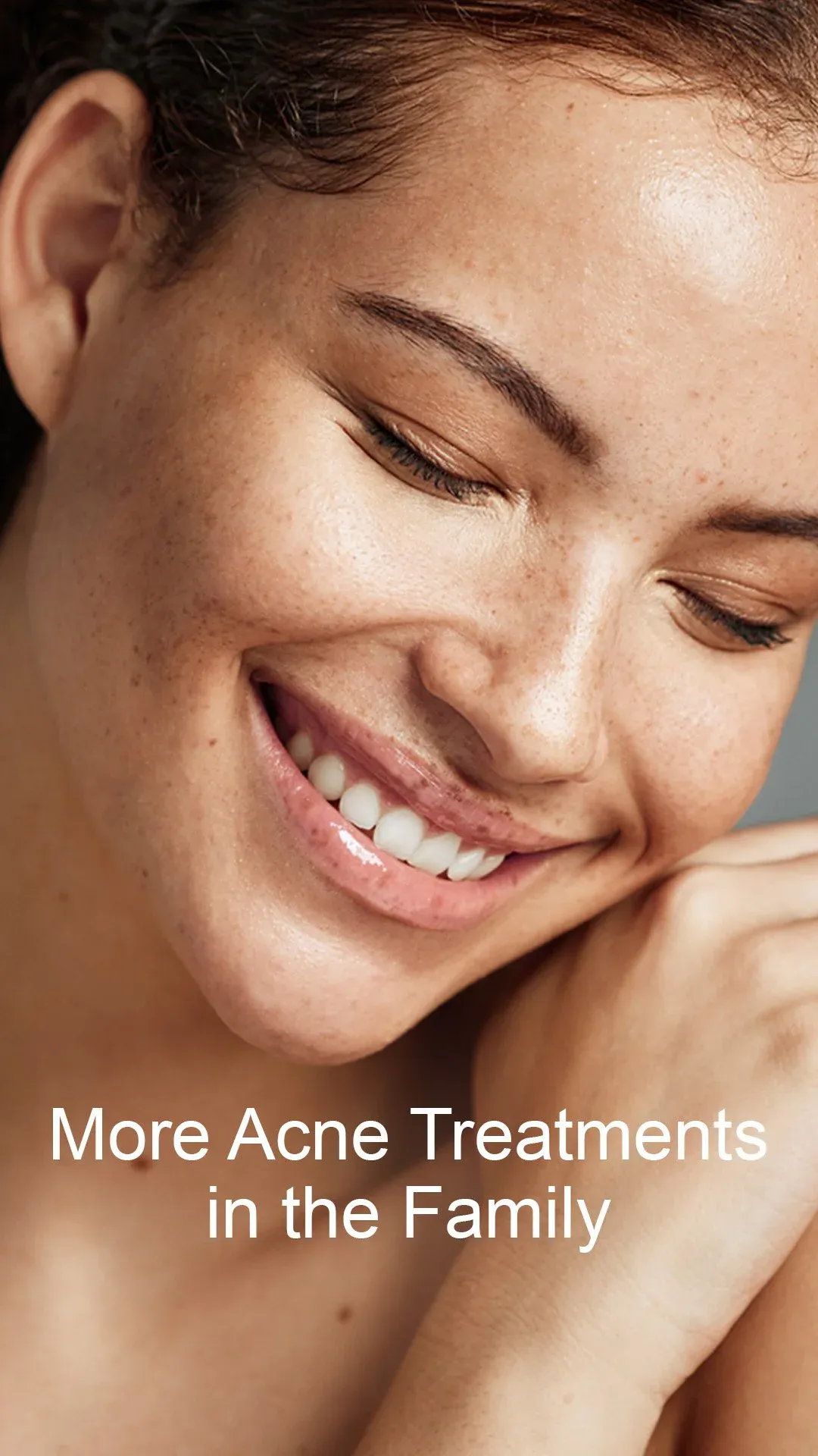 HydraFacial Acne booster