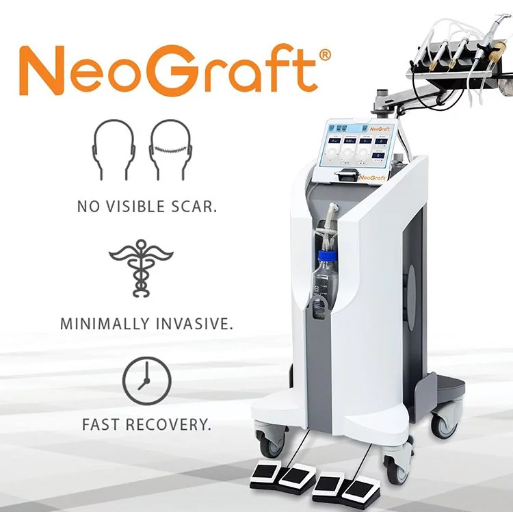 NeoGraft® Hair Restoration: The Minimally Invasive FUE Procedure Changing the Game