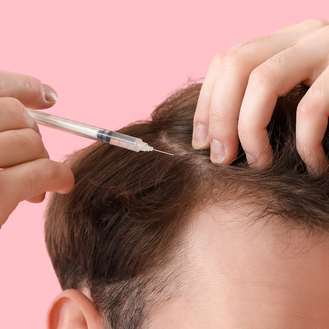 PRP Therapy: Using Your Body to Regrow Hair