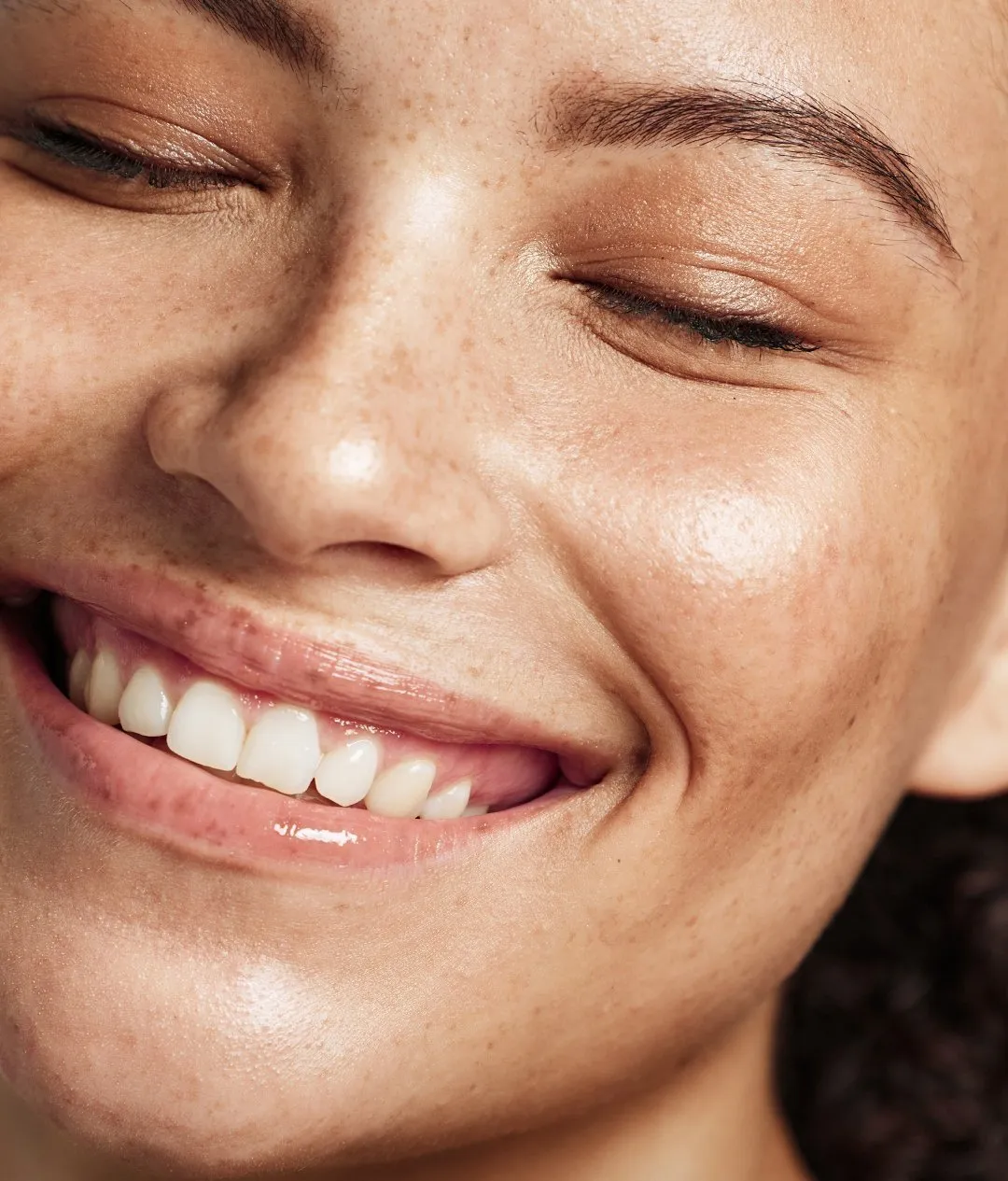 Botox® treatment at Remedy+ Grand Rapids MI