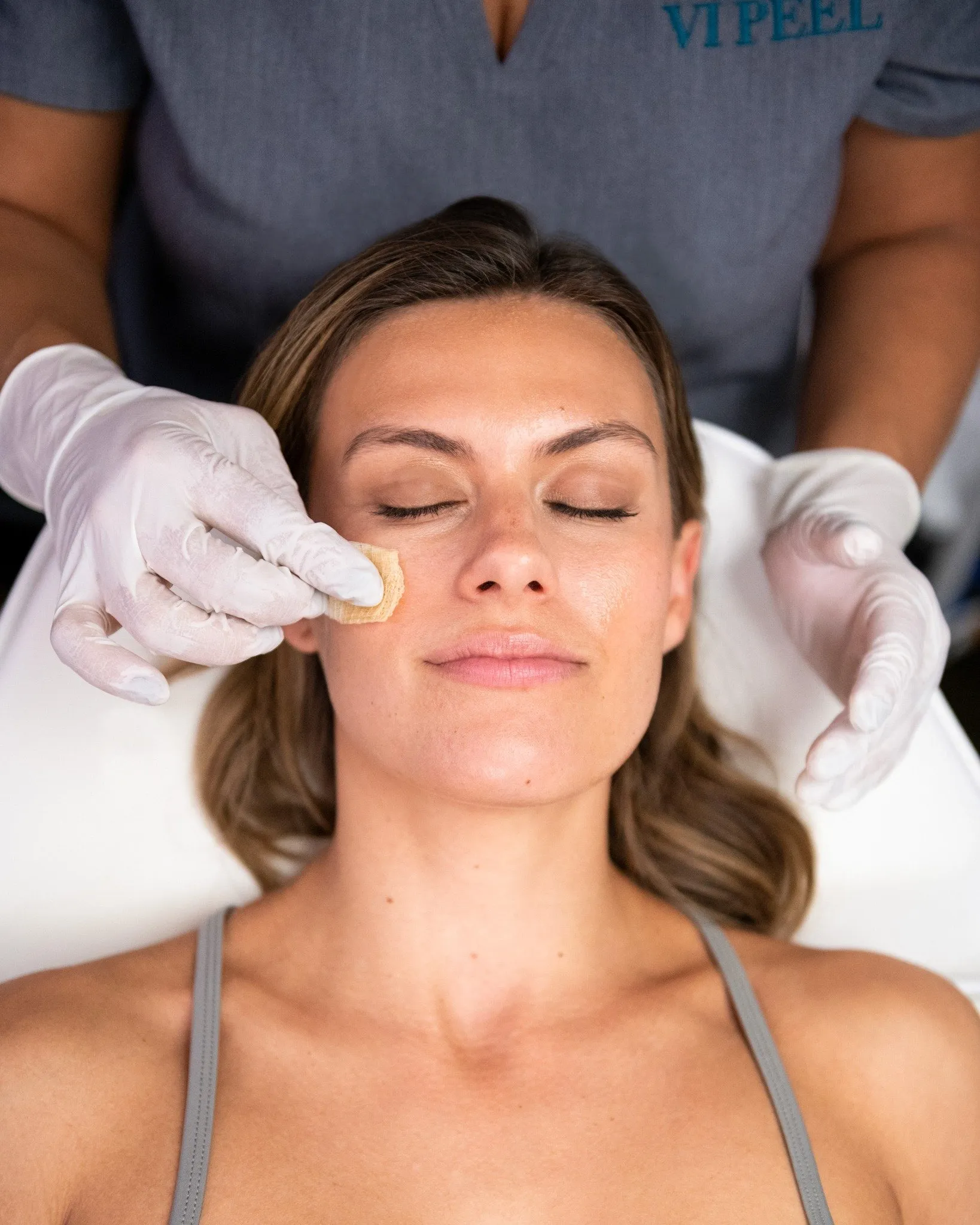 Chemical Peels treatment at Remedy+ Grand Rapids MI