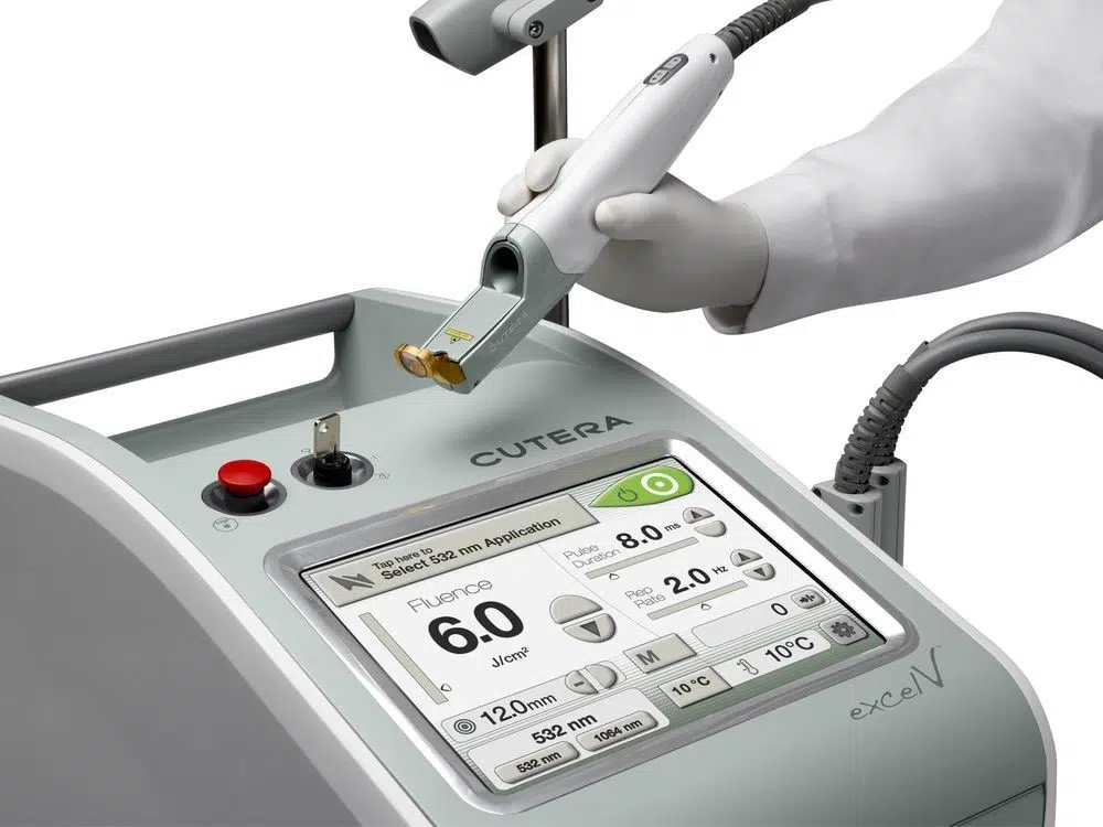 CUTERA CoolGlide® device at Remedy+