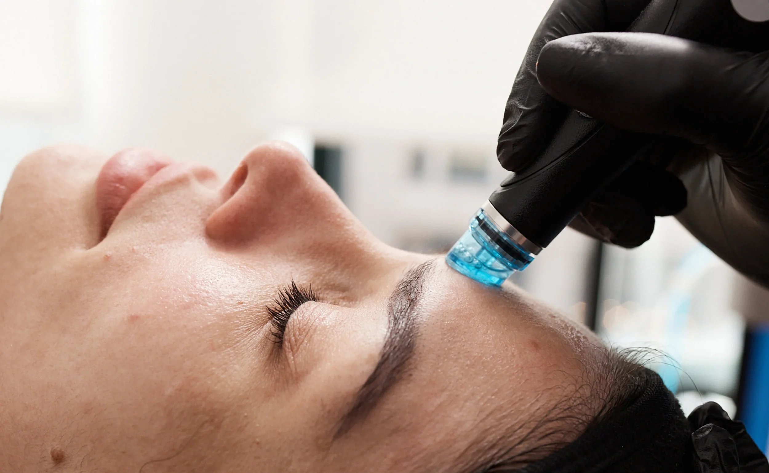 HydraFacial™ treatment at Remedy+ Grand Rapids MI