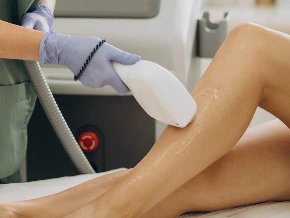 Laser hair removal therapy on legs