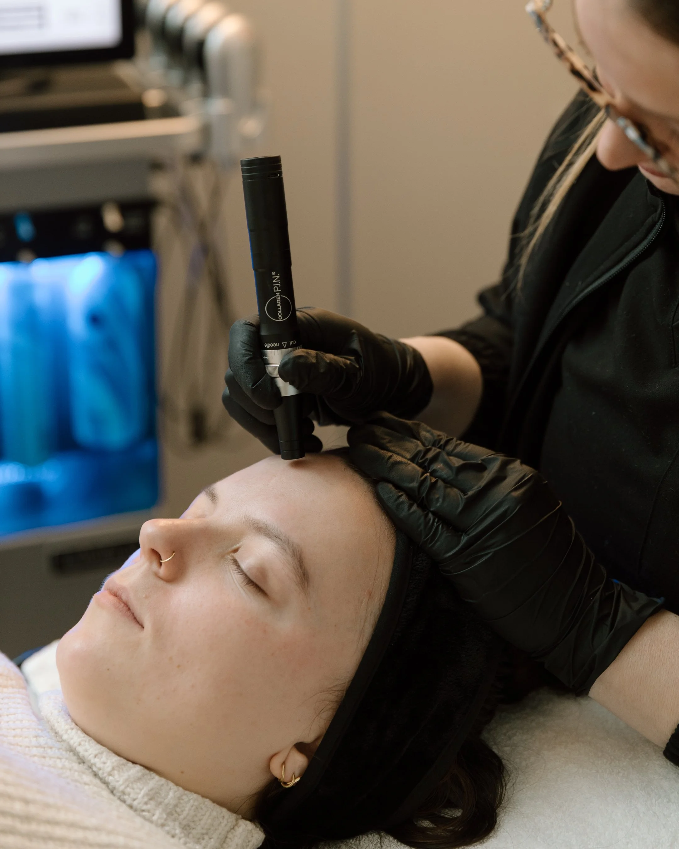 Microneedling treatment being performed on patient's forehead at Remedy+