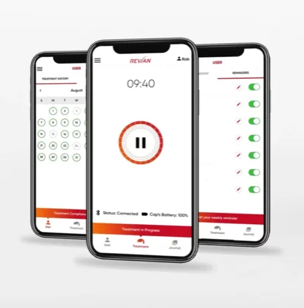 REVIAN companion app showing treatment timer, history, and reminders