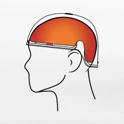 Diagram showing REVIAN Red full scalp coverage from front to crown