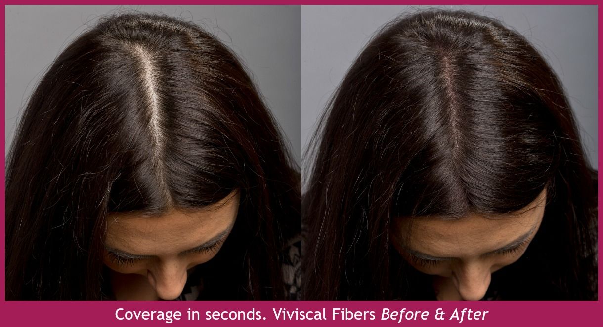 Viviscal hair fibers before and after — instant coverage at the part in seconds