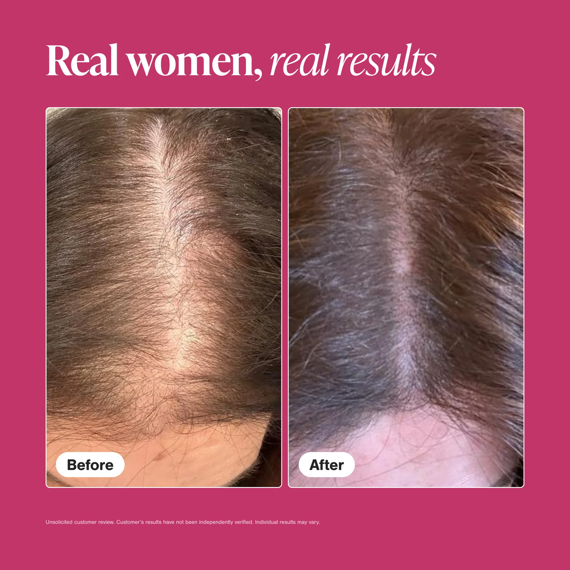Real women, real results — before and after showing fuller scalp coverage at the part