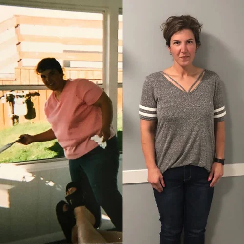 Weight loss before and after — female client at Remedy+