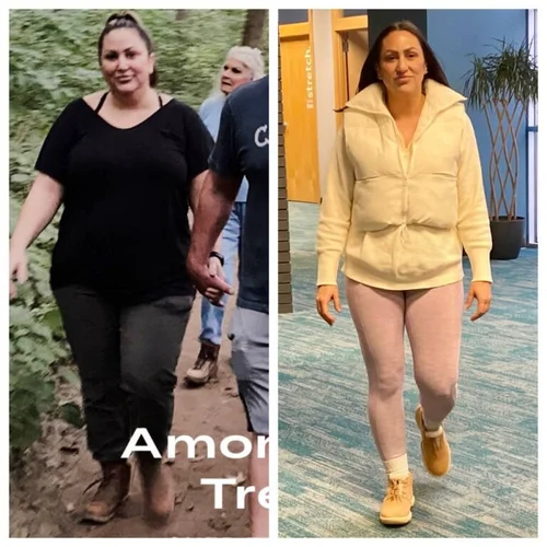Weight loss journey — female client at Remedy+ Grand Rapids